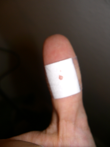 mein Daumen mit einem Schnitt von ca. 2 cm